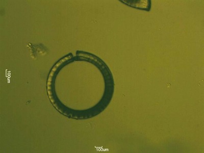 Enlarged view: A hydrogel stimuli sensitive ring produced by standard photolitography.